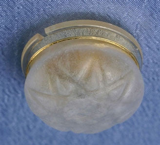 Ceiling Fixture with Frosted Globe